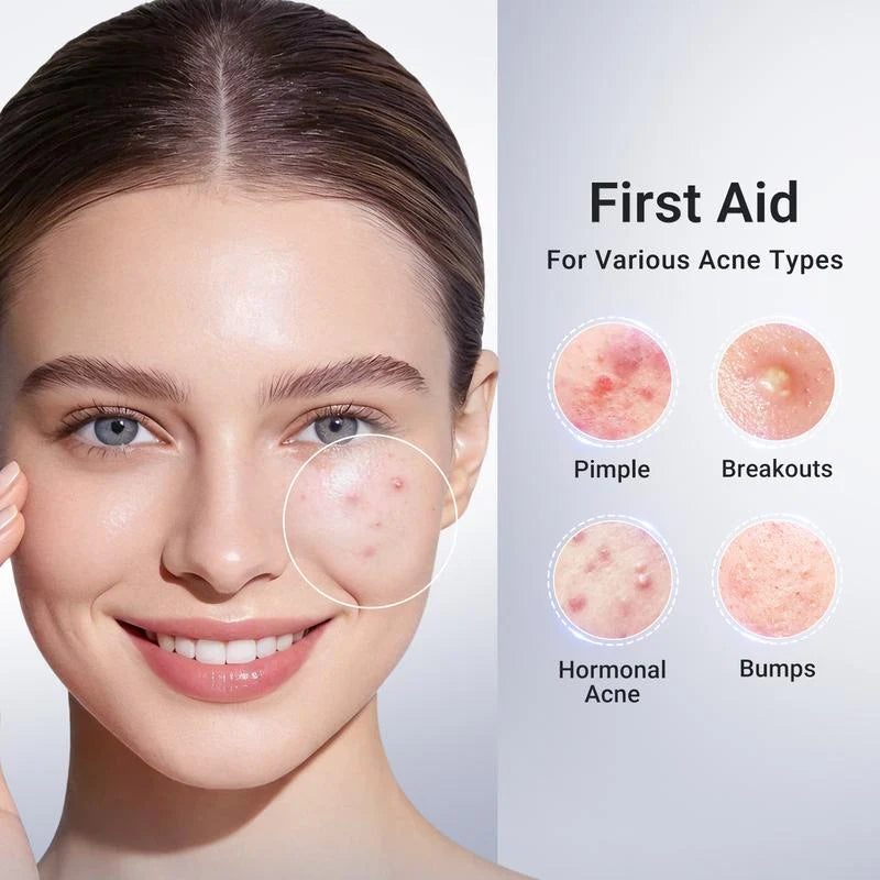 Blemish Rescue Drop