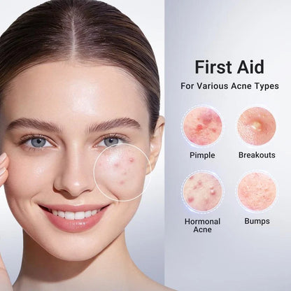 Blemish Rescue Drop